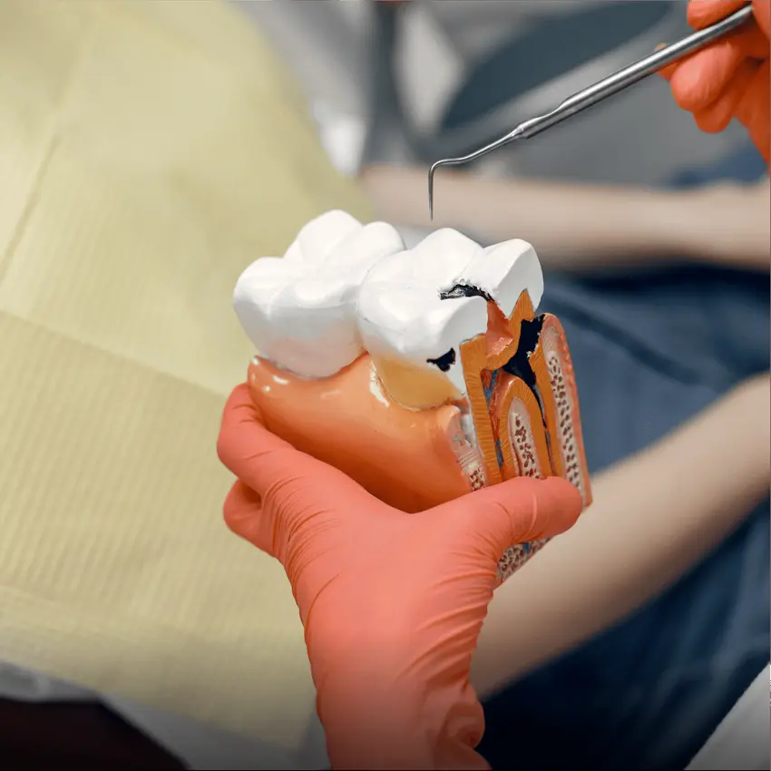 Endodontia e desvitalização